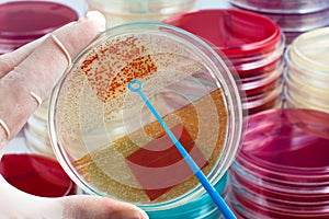 Growth of colonies of bacteria in culture medium plate