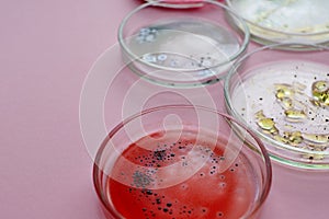 Growth of different bacterial cultures, concept. Bacteriological examination. Harmful and beneficial bacteria,