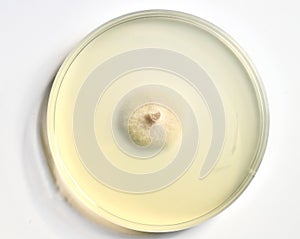 growth of microorganisms in a Petri dish, Bacteria, yeast and mold growing on an agar plate.