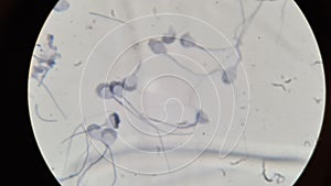 Guinea pig spermatozoa under microscope