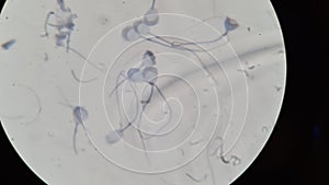 Guinea pig spermatozoa under microscope