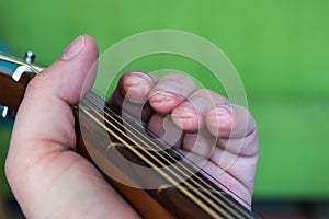 Guitarist fingers calluses photo