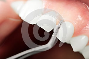 Gums examination equipment. Close up