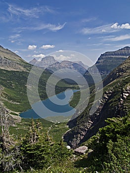 Gunsight Lake and Mountains