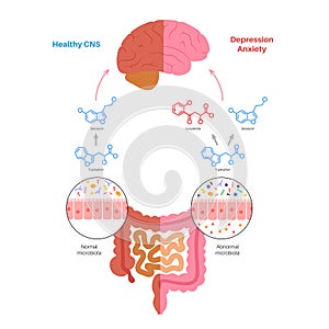 Gut brain connection photo