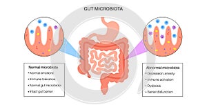 Human gut microbiota photo