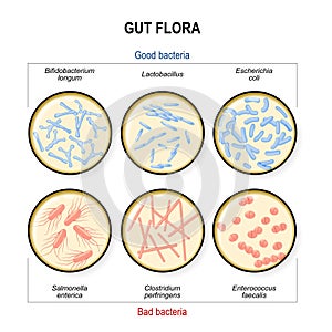 Gut flora. Bad bacteria: Clostridium, Enterococcus, Salmonella and Good bacteria: Lactobacillus, Bifidobacterium, Escherichia coli photo