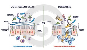 Gut homeostasis and dysbiosis immune response differences outline diagram photo