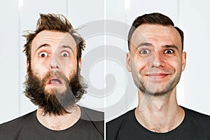 Guy with beard and without hair loss. Man before and after shave or transplant. haircut set transformation