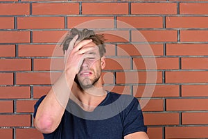 Guy with bristle in dark blue tshirt suffers from headache