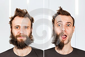 Guy with half beard and without hair loss. Man before and after shave or transplant. haircut set transformation