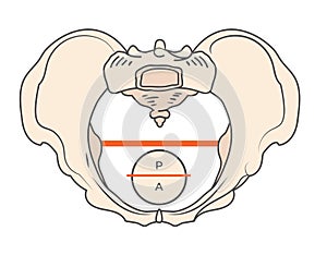 Gynecoid Pelvis Shape with Round / Circular shape