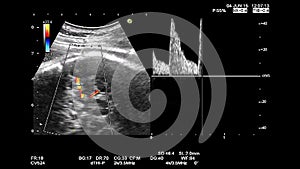 Gynecological echography medical examination. 33 weeks old pregnancy with estimated size of the fetus check, high definition