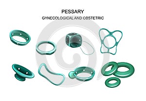 Gynecological and obstetric pessary photo