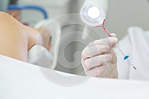 Gynecologist holding an IUD birth control device before using it for patient