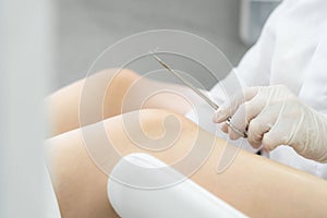 Gynecologist holding needle for stitching before surgery