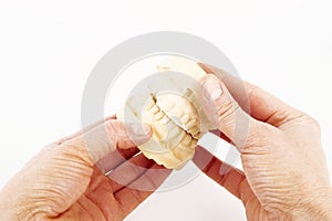 Gypsum model for denture