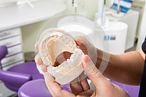 Gypsum model of jaw with teeth in in the hands of a dentist