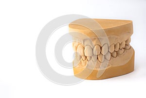 Gypsum model plaster of tooth photo