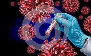 H5N1 virus diagnosis