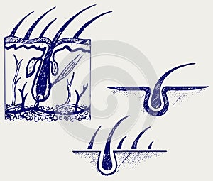 Hair anatomy and hair follicle