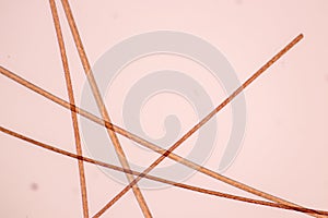 Hair cell of human under microscope view.