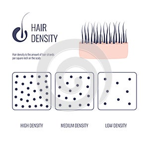 Hair density types chart of low, medium, high strand volume photo