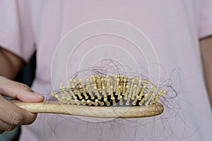 Hair fall in hairbrush stress problem of woman. Young woman holding a brush showing her comb brushing hair with long hair loss