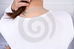 Hair fall problem. Back shot covering with hair fall. Healthcare medical or daily life concept