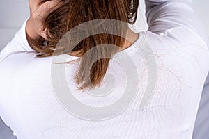 Hair fall problem. Back shot covering with hair fall. Healthcare medical or daily life concept