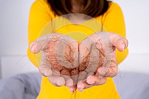 Hair fall problem, closeup hand holding problem hair. Healthcare medical or daily life concept