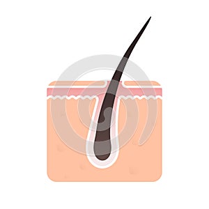 Hair follicle structure vector flat icon. Hair bulb follicle pore, head skin dermatology treatment, dandruff shampoo and hair