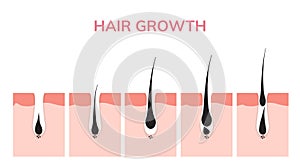 Hair growth cycle skin. Follicle anatomy anagen phase, hair growth diagram illustration