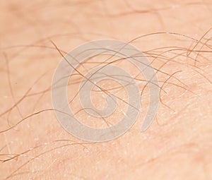 The hair on the human skin