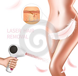 Hair Laser Removal Procedure on Female Bikini Area photo