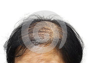 Vlasy strata 
