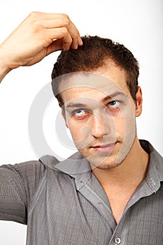 Hair loss concept - young man worried about baldness