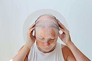 Hair loss in the form of alopecia areata.