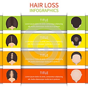 Hair loss infographic template