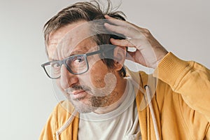 Hair loss, man looking at the mirror concerned about losing his hair at forehead