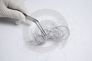 Hair loss specialist, wearing gloves, using forcep to pick up hair.