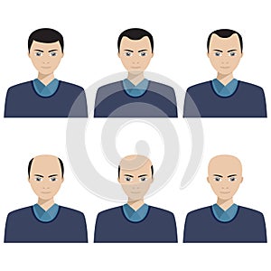 Hair loss stages and types of baldness. photo