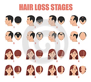 Hair loss stages vector isolated. Female and male