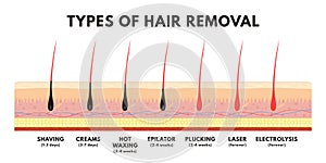 Hair removal concept. Shaving, depilation cream, waxing, epilator, plucking, laser hair removal and electrolysis