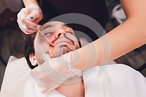 Hair removal. Man& x27;s face sugaring epilations beard trimming, yellow color, in cosmetology on the couch.