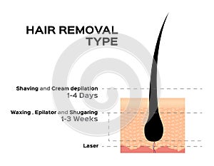 Hair removal type shaving cream depilation waxing epilator shugaring and laser