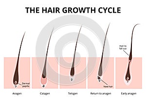 Hair structure