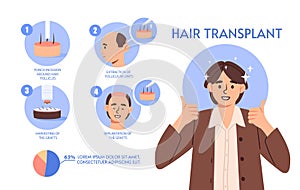 Hair transplant infographic vector concept