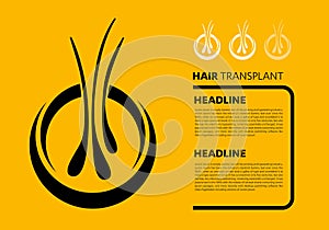 Hair transplantation , follicle, growth, treatment, root