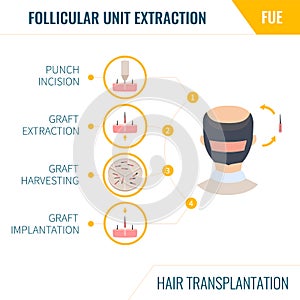 Hair transplantation by FUE method in men photo